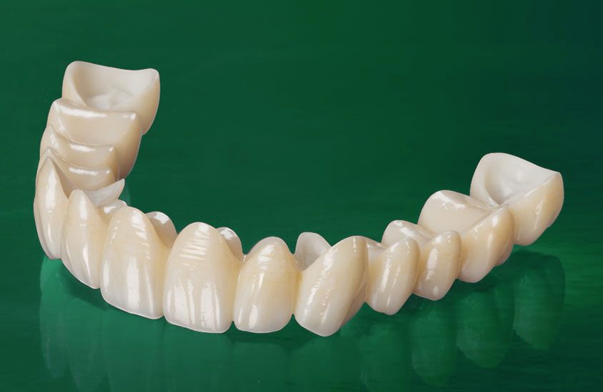 Full-arch zirconia restoration made at Denco Dentals